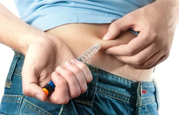 Huda sladkorna bolezen tipa 2 zahteva dajanje insulina